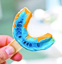 dental mouth imprint